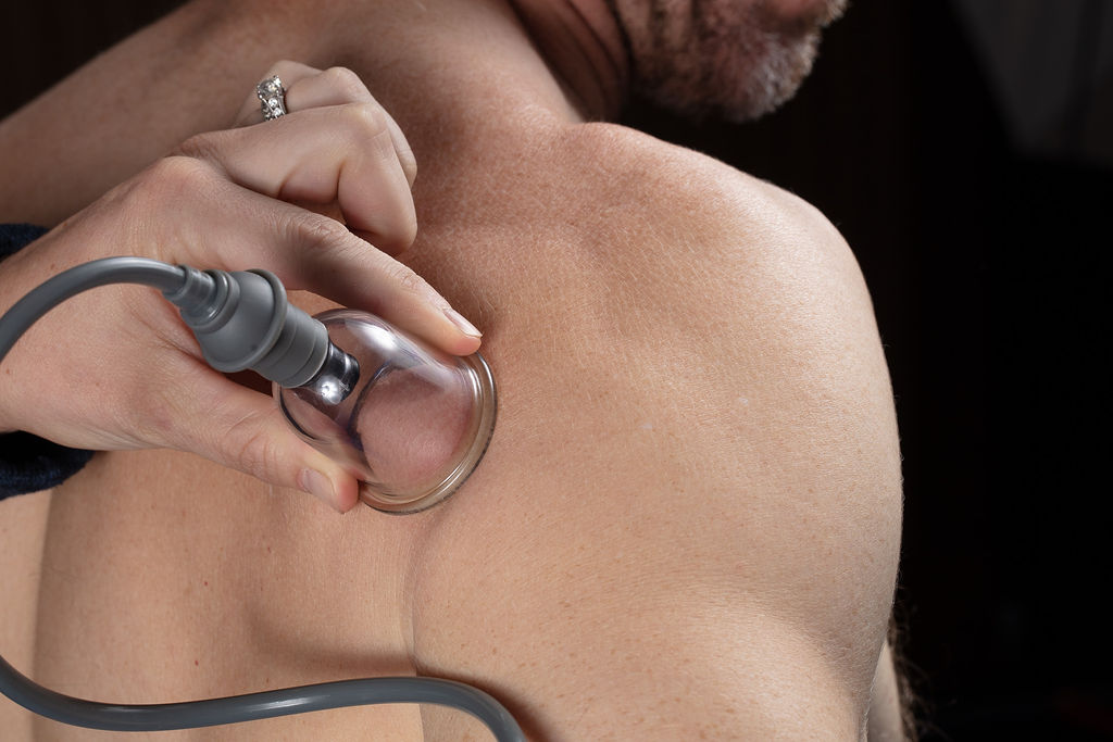 A therapist applying a cupping device to a patient's shoulder